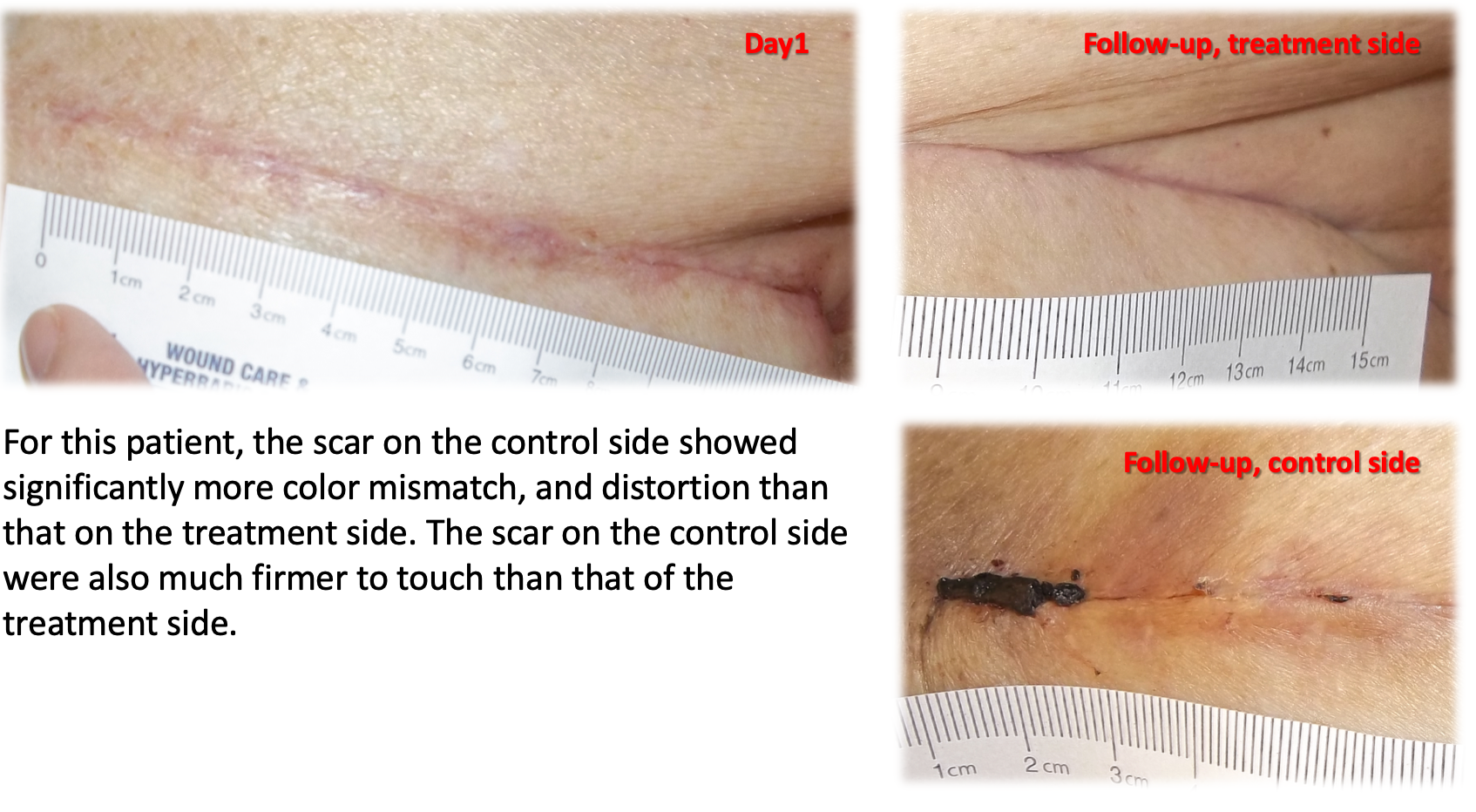 CICATRICELL Advanced Botanical Scar Fade System